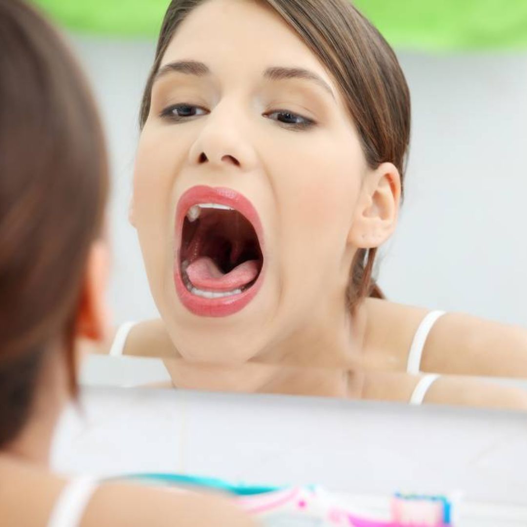 Candidose Candida albicans : symptômes, traitement et prévention