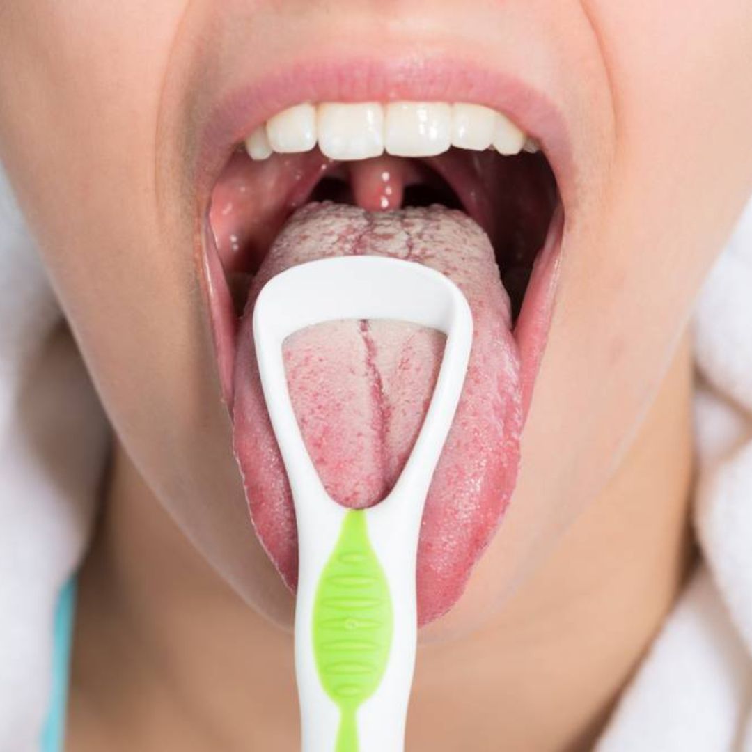 Candidose - Complément Alimentaire - Canda'Plus - SFB Laboratoires