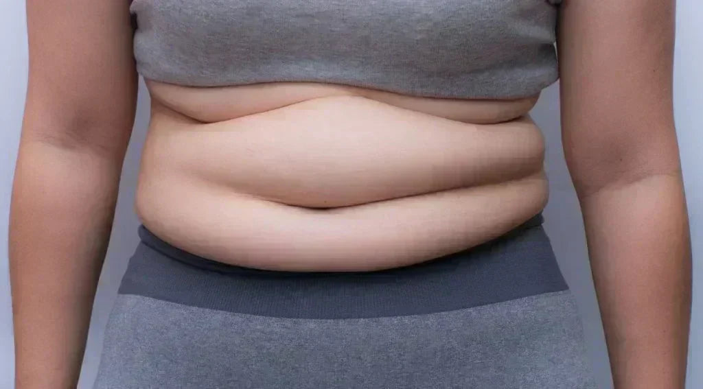 Lactobacillus gasseri SBT2055 : probiotique efficace contre la graisse abdominale