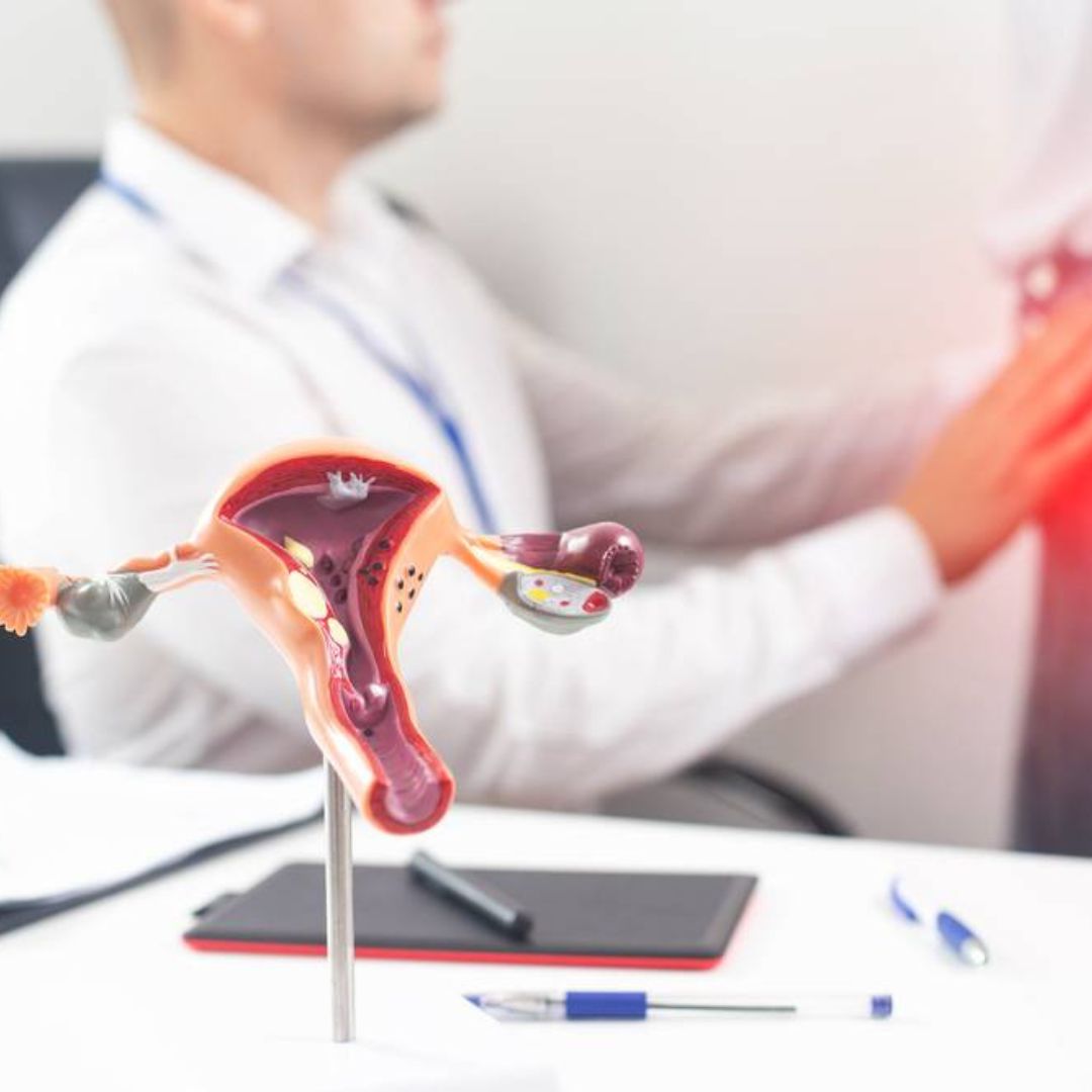 Quels traitements pour une candidose génitale ?