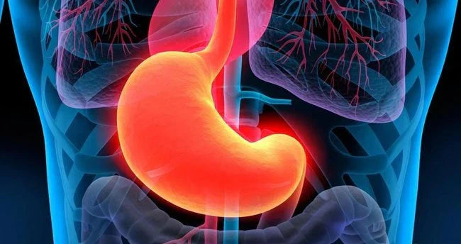 Gastrite : symptômes, causes et alimentation pour soulager naturellement l'inflammation